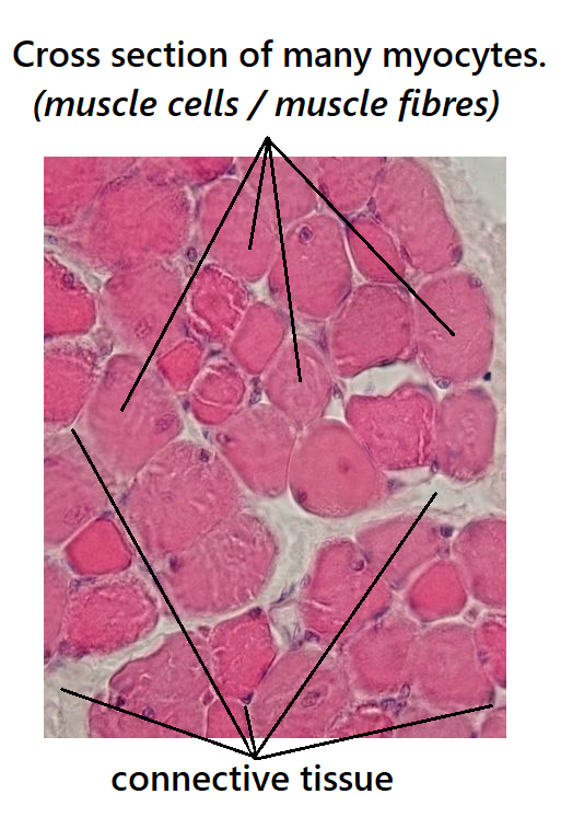 individual muscle cells shown in a cross section of skeletal muscle under the microscope. Each muscle cell is surrounded by connective tissue.