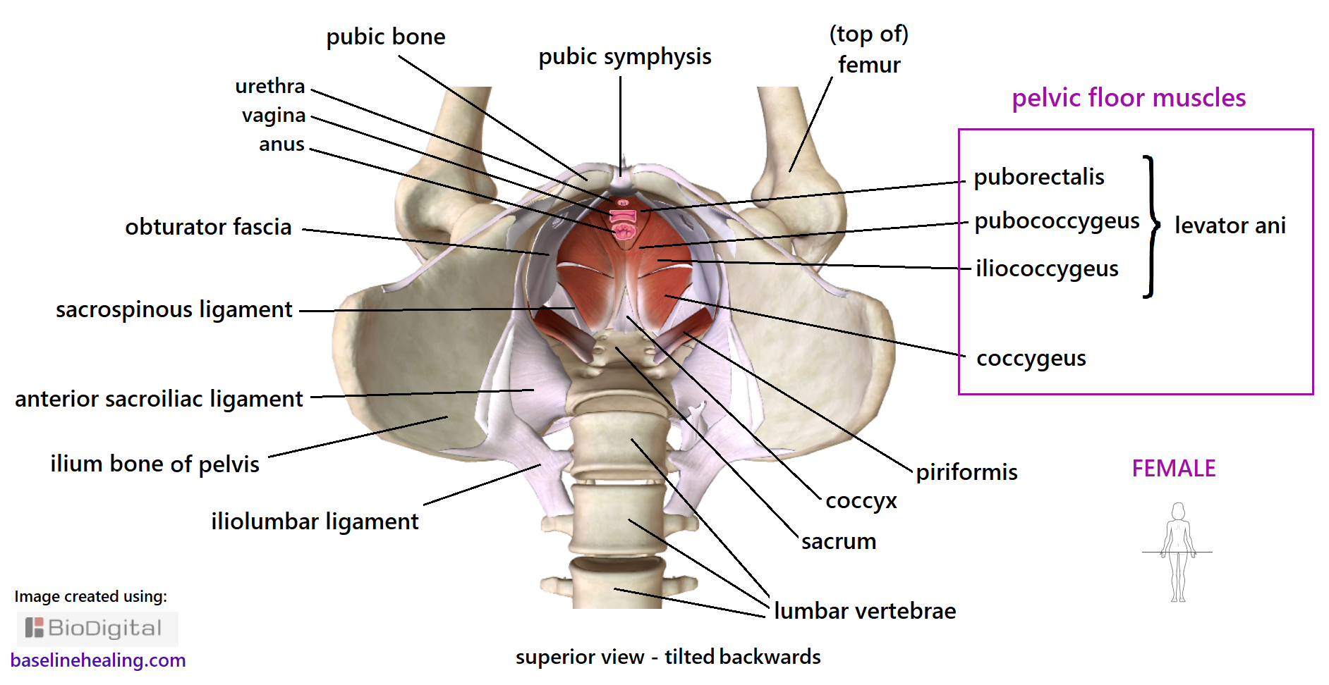 The female pelvis seen from above. Pelvic floor muscles, bones and connective tissues. Showing the ilium bones, the large wings of the pelvis and the smaller pubic bones at the front of the pelvis which are separated by the pubic symphyis on the body's midline. The sacrum and coccyx bones at at the back of the pelvis at the base of the spine. The levator ani muscles group is part of the pelvic floor, consisting of 3 muscles on either side of midline - the puborectalis, pubococcygeus and iliococcygeus muscles. The puborectalis muscles are small and located at the front of the pelvic floor, surrounding the anus, vagina and urethral openings and  are named for its proximity to the pubic bone and anus. The pubococcygeus muscles attach to the pubic bones and the coccyx. They are like ribbons forming an X-shape from front to back of the pelvic canal, either side of midline. The iliococcygeus muscles are the biggest of the levator ani muscles, wide and thin and most of the front half of the pelvic floor meeting . The coccygeus muscles make up the back half of the pelvic floor meeting with the bottom half of the X of the pubococcygeus. The coccygeus and iliococcygeu are similar in shape wide and flat. Several connective tissue structures are also labelled. The anterior sacroiliac ligament, a broad sheet of connective tissue attaching to the inside of the wings of the ilium and to the sacrum.  The iliolumbar ligament also attaches to the wings of the ilium but then extends higher to the lumbar vertebrae.  The obturator fascia covers the inside of the front portions of the pelvic canal. Also shown the part of the piriformis muscle that is within the pelvic canal. The piriformis goes through the greater sciatic foramen.  A lot of complex anatomy, layered and blending with the pelvic floor as the muscular base of the body.